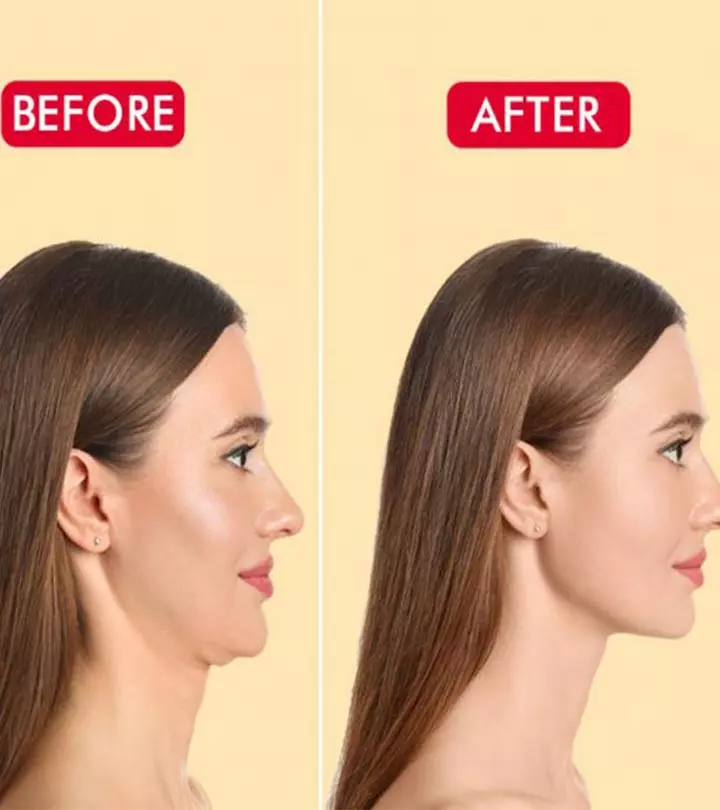 10 Best Ways to Tighten Saggy Neck Skin Naturally
